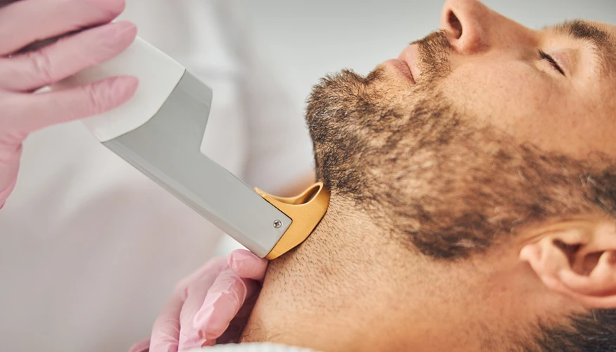 How Beard Laser Hair Removal Changes Appearance?