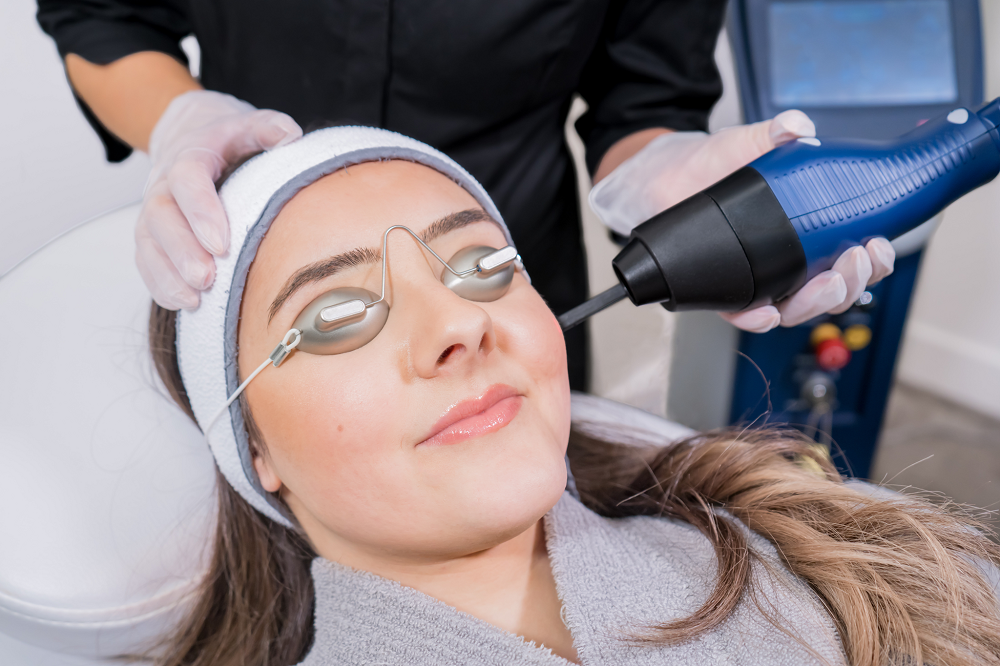 How CO2 Laser Treatment Targets Sun Damage