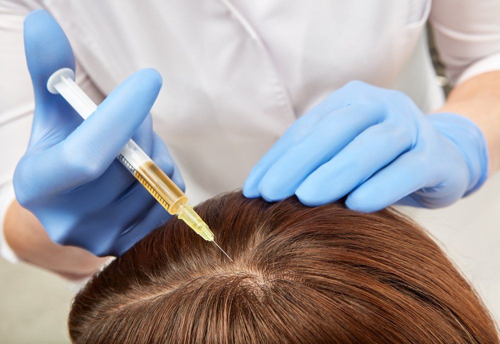 How PRP Treatment Works on Thinning Hairlines