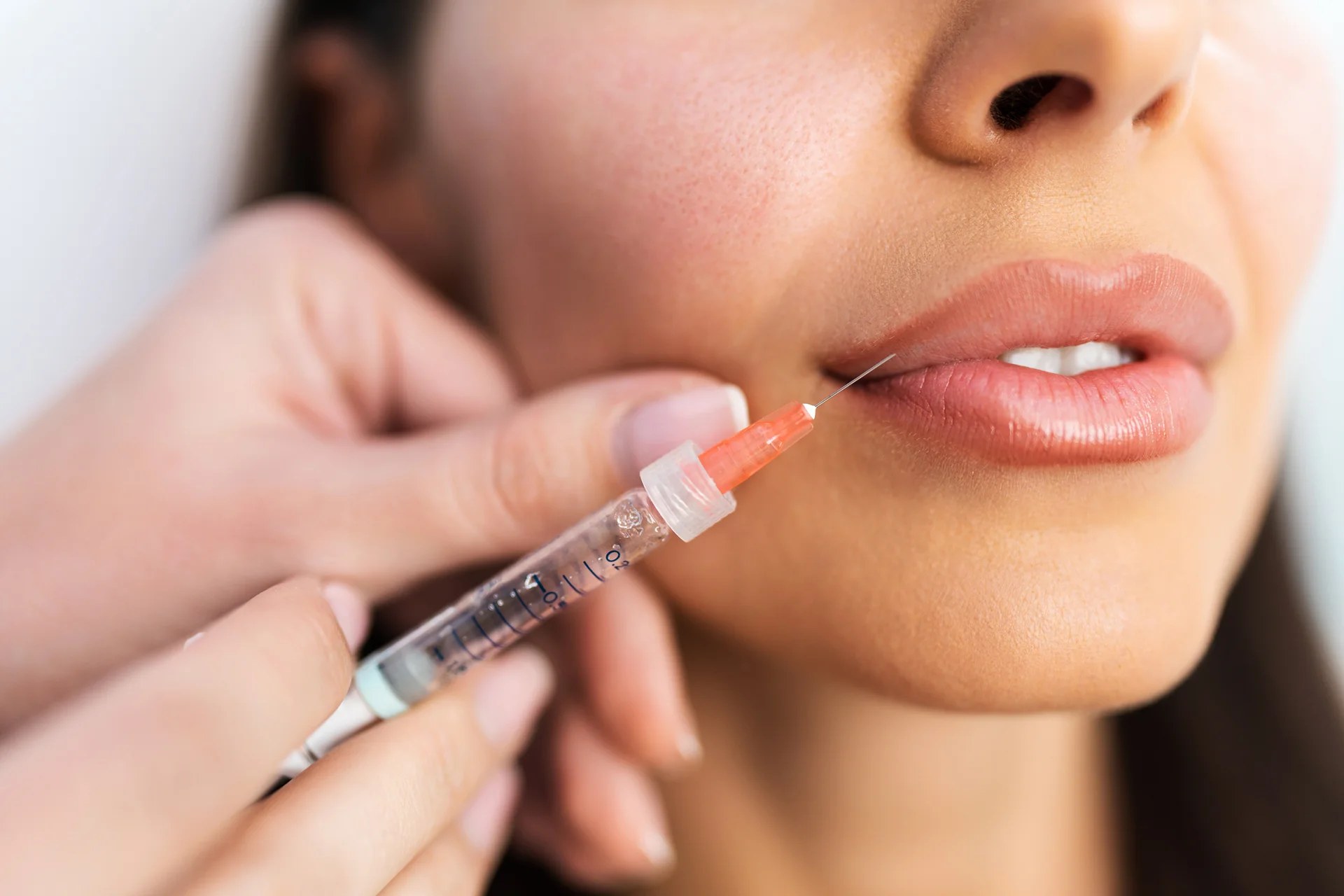 How to Know If You Need Lip Fillers or Not