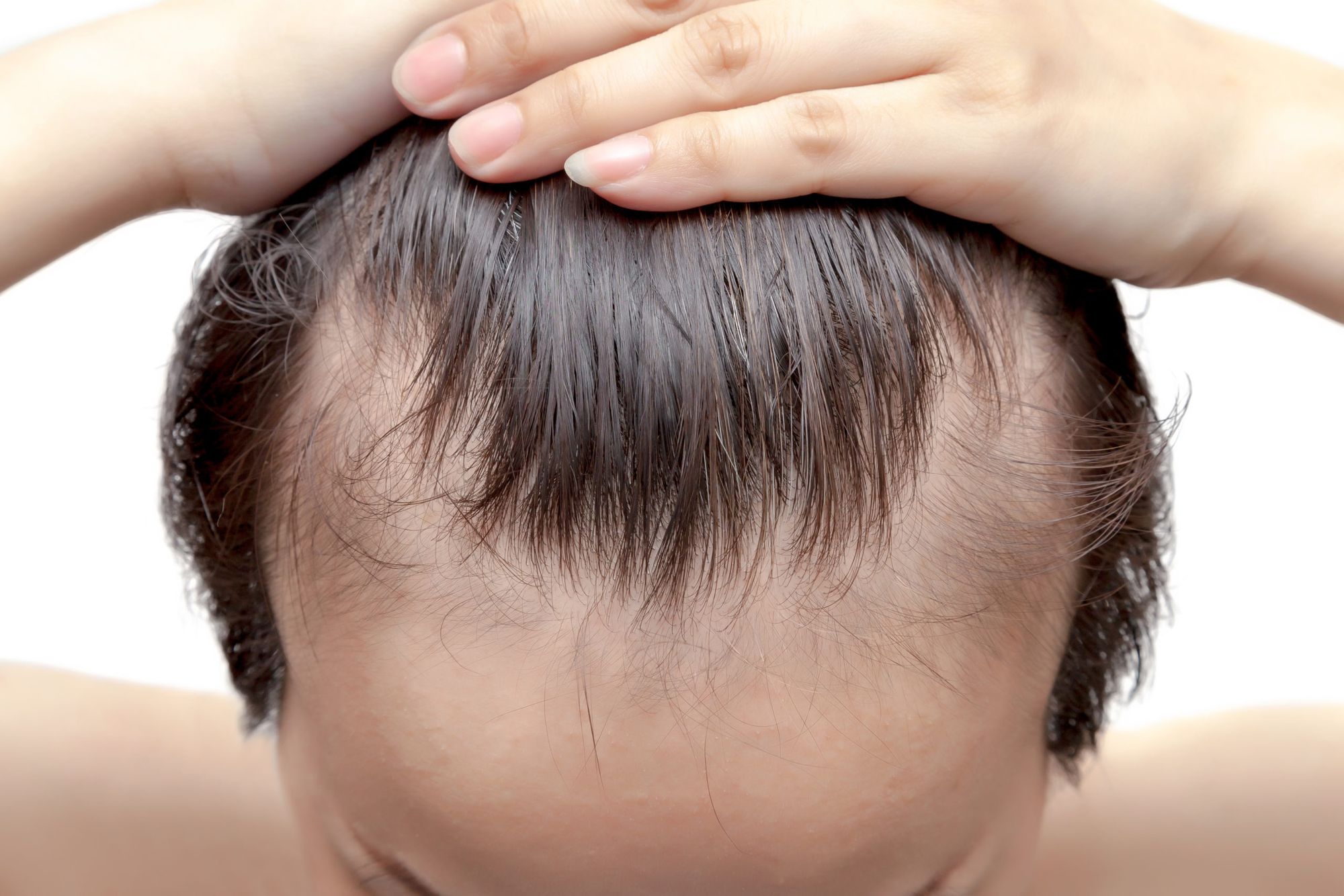 Is Scalp Micropigmentation Safe for All Scalps?