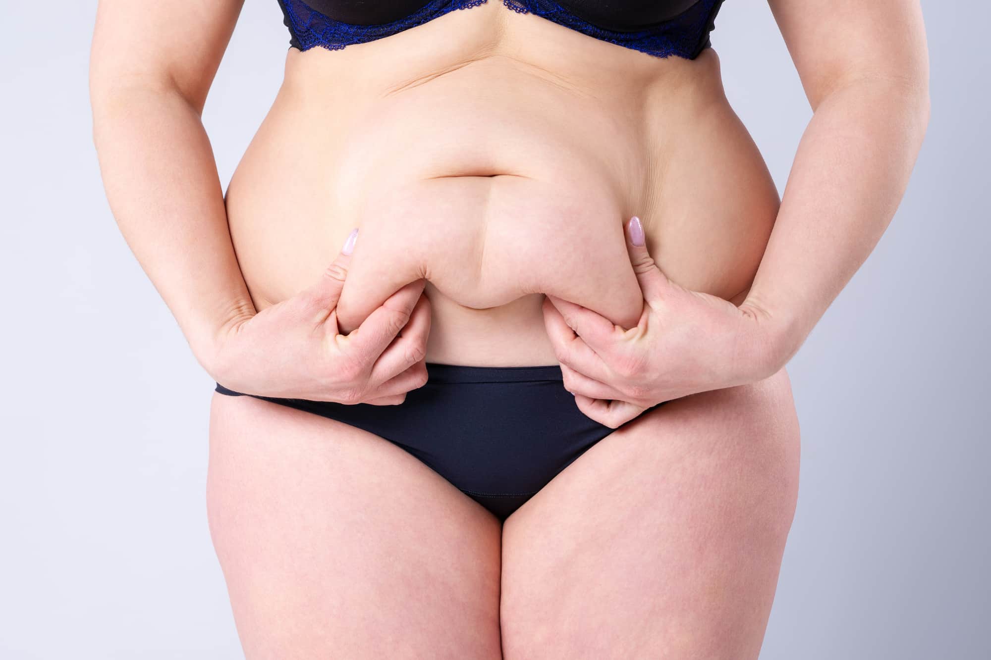 How Does Liposuction Surgery Compare to Tummy Tucks?