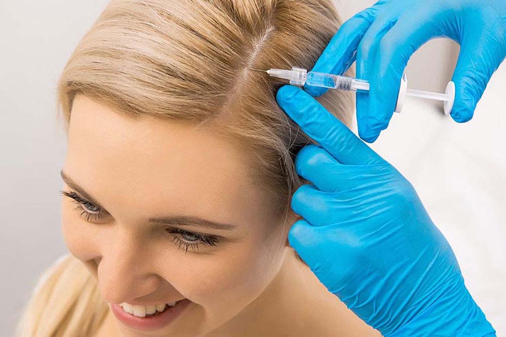 How PRP Hair Treatment Works on Scalp?