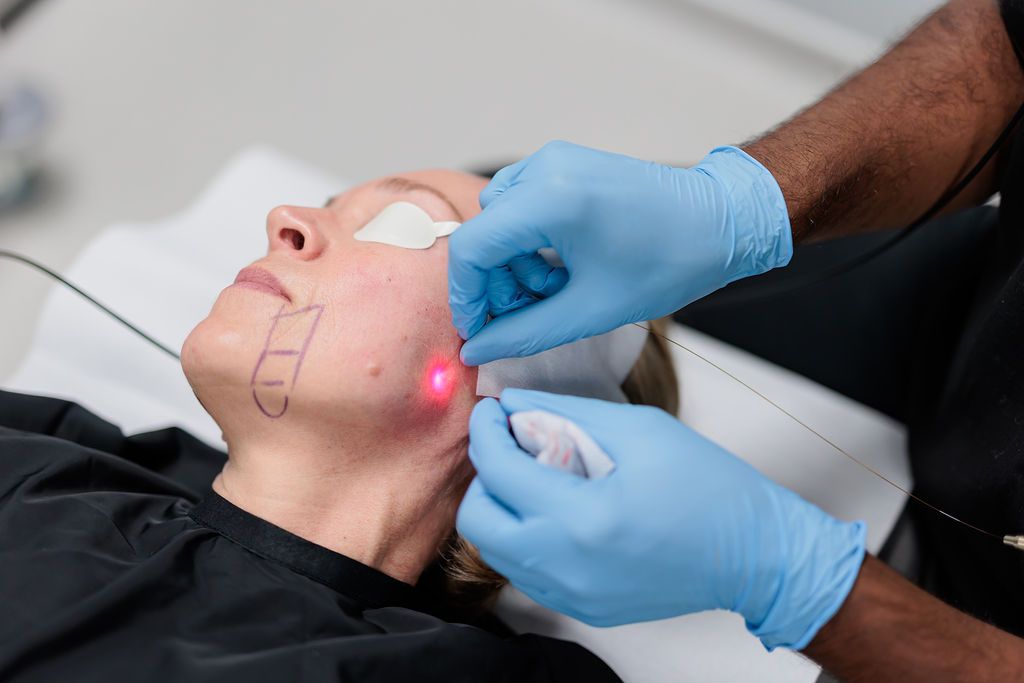 Is EndoLift an Effective Anti-Aging Solution?