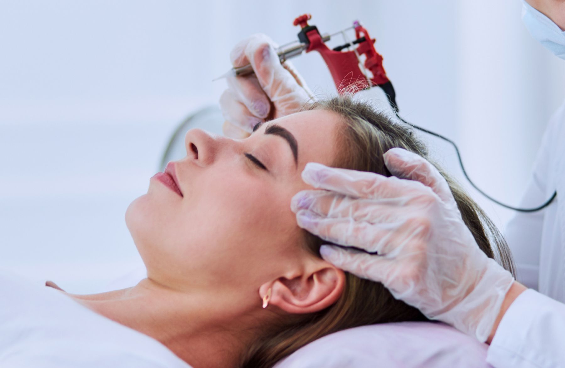 Does Scalp Micropigmentation Work for Women?