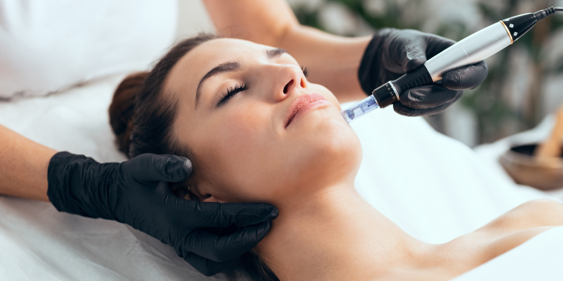What Is the Best Age for Dermapen Treatment?