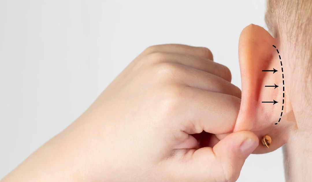 How Otoplasty Helps Correct Large Ears