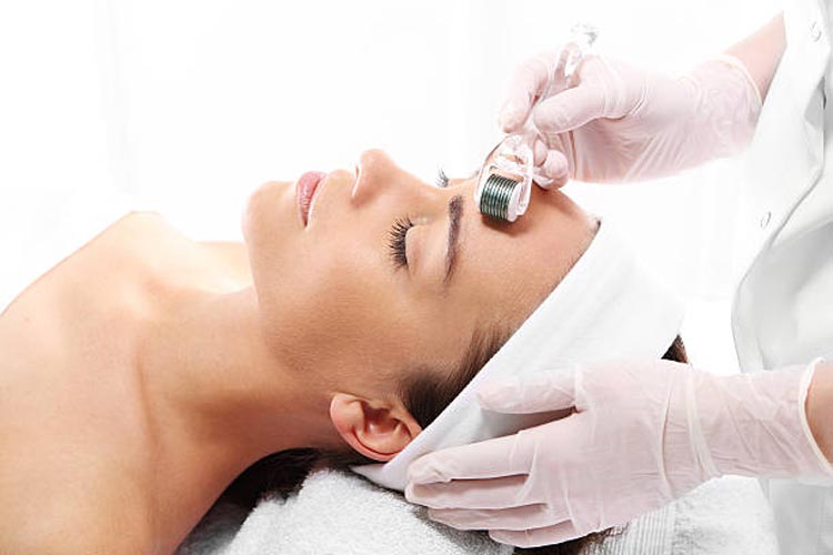 How Fast Is Recovery After Derma Roller Treatment?